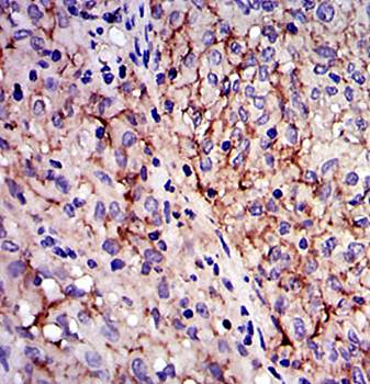 KIT Antibody
