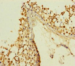 KIZ Antibody