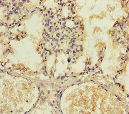 KIZ Antibody
