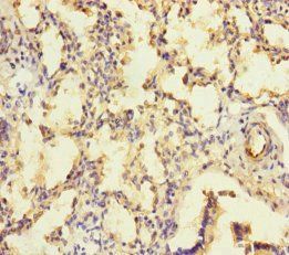 KIZ Antibody