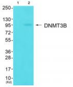 DNMT3B Antibody