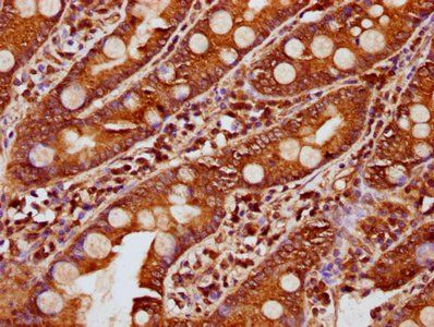 KLB Antibody