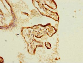 KLC1 antibody