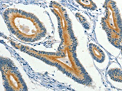 KLC1 antibody