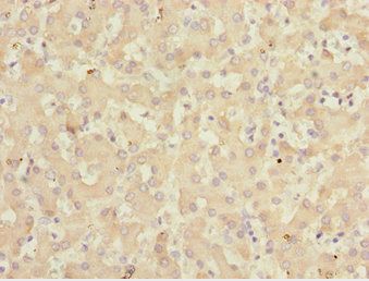 KLF15 Antibody