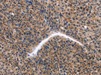 KLF15 Antibody