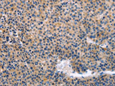KLF15 Antibody