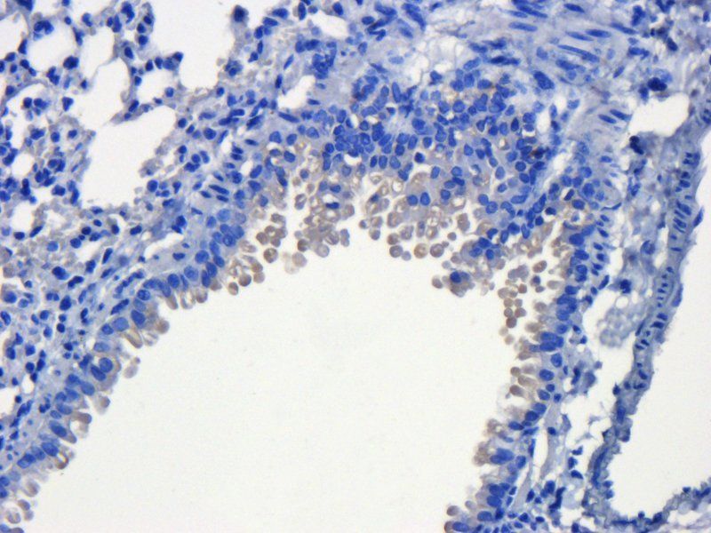 KLF2 antibody