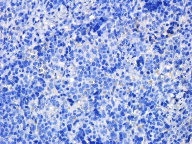 KLF2 antibody