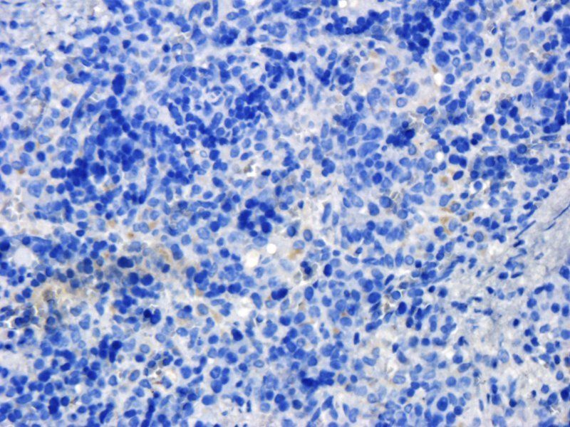 KLF2 antibody