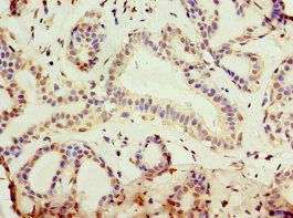 KLF3 Antibody