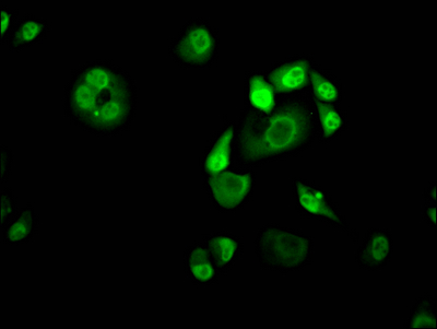 KLF4 Recombinant Monoclonal Antibody