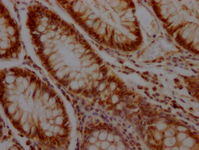 KLF4 Recombinant Monoclonal Antibody