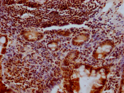 KLF4 Recombinant Monoclonal Antibody