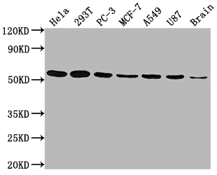 KLF4 Recombinant Monoclonal Antibody