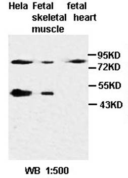 KLF8 Rabbit Polyclonal Antibody