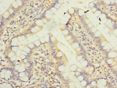 KLHDC8A Antibody