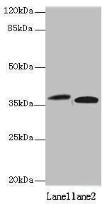 KLHDC8A antibody
