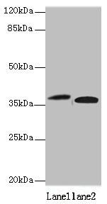 KLHDC8A Antibody