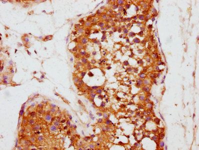 KLHL12 Antibody