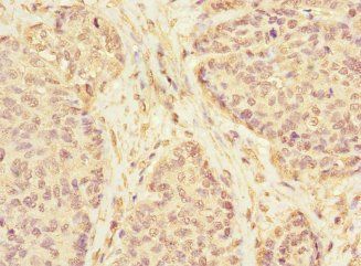 KLHL13 Antibody