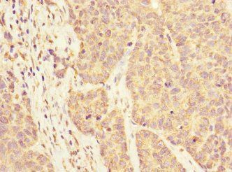 KLHL13 Antibody