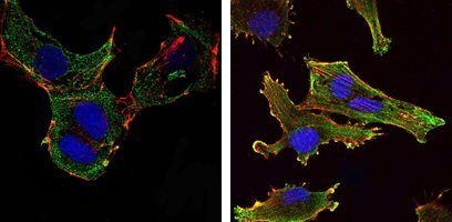 KLHL13 Antibody