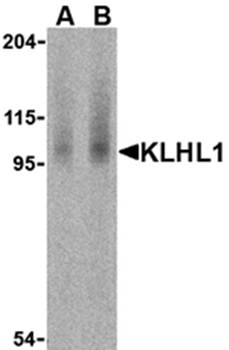 KLHL1 Antibody