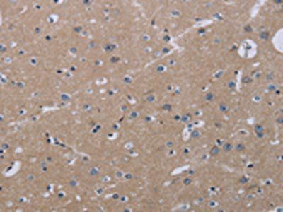 KLHL2 Antibody