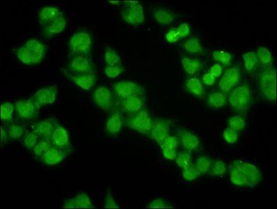 KLHL20 Antibody