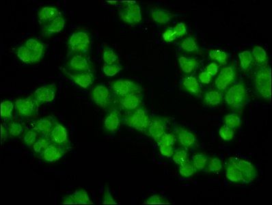 KLHL20 antibody