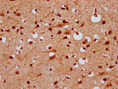 KLHL20 Antibody
