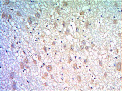 KLHL21 Antibody