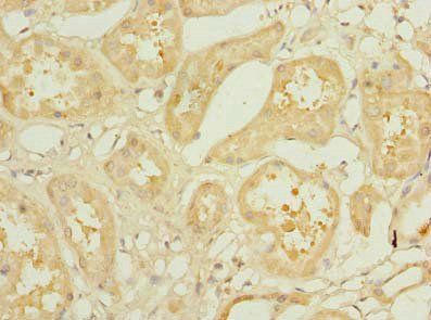 KLHL42 Antibody