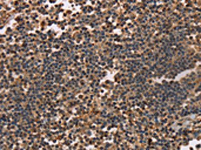 KLK14 Antibody