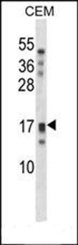KLK15 antibody