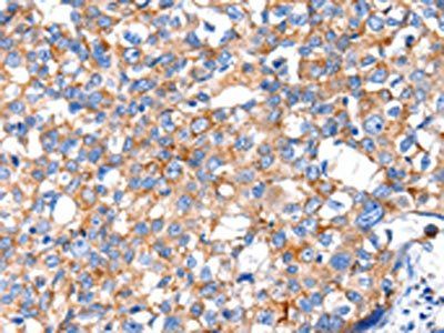 KLK15 Antibody
