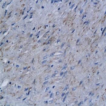 KLKB1 antibody