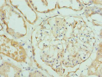 KLK4 Antibody