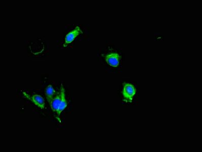 KLK6 Antibody