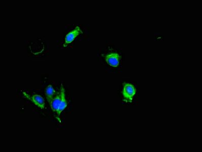 KLK6 antibody