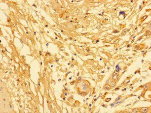 KLK6 Antibody