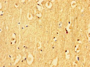 KLK6 Antibody