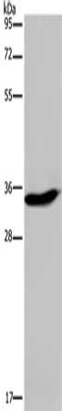 KLK6 antibody