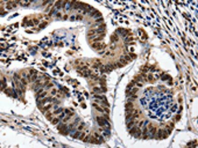 KLK7 Antibody