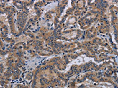 KLK8 Antibody