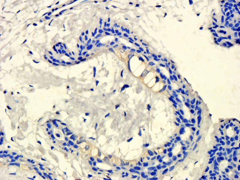 KLKB1 antibody