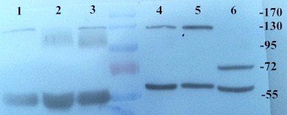 KLKB1 antibody