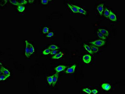 KL Antibody