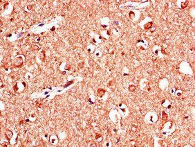 KL Antibody